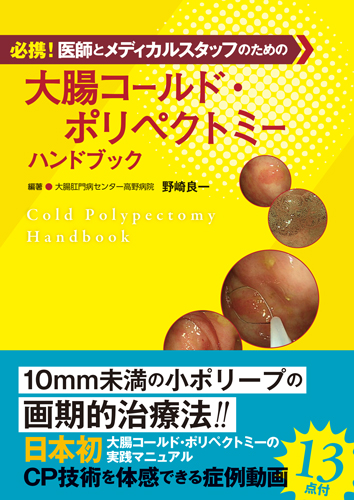 必携！医師とメディカルスタッフのための大腸コールド・ポリペクトミー